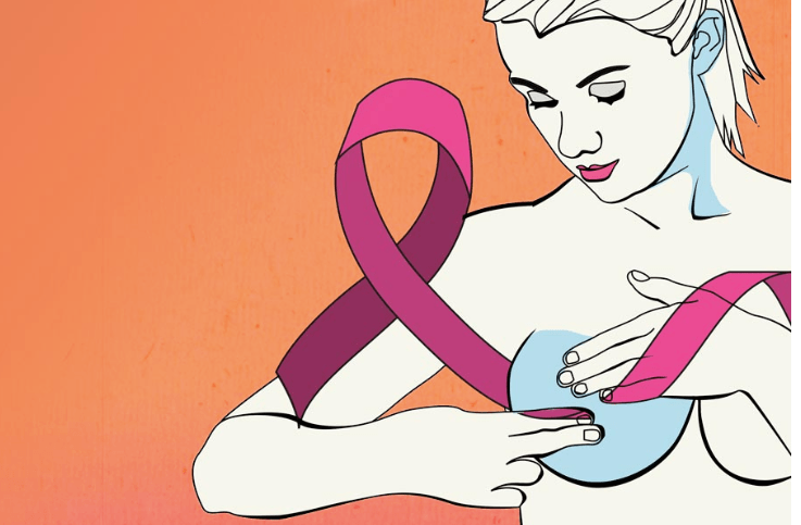 Fallecen 12 mujeres al día por cáncer de mama en México: UNAM/ Gaceta UNAM